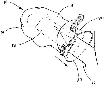 A single figure which represents the drawing illustrating the invention.